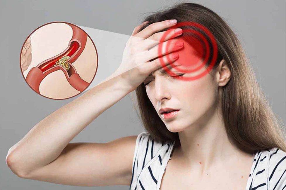 Thiếu máu não: Mối nguy hiểm cận kề mà bạn cần phải biết
