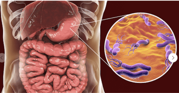 Nhiễm H.pylori (HP) là gì? H.pylori lây qua đường nào?