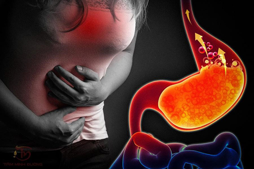 Viêm Loét Dạ Dày: Dấu Hiệu, Nguyên Nhân và Cách Điều Trị Tại Nhà Hiệu Quả