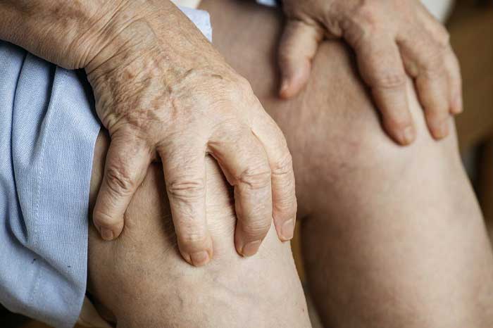 Nguyên nhân, triệu chứng, chẩn đoán và điều trị bệnh gout (gút)