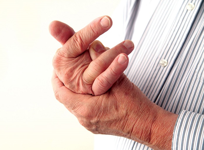 Nguyên nhân, triệu chứng, chẩn đoán và điều trị bệnh gout (gút)