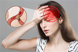 Thiếu máu não: Mối nguy hiểm cận kề mà bạn cần phải biết