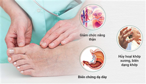 thong-ke-nhung-bien-chung-nguy-hiem-cua-benh-gout-gut-thuong-gap