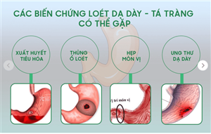 Thủng dạ dày là gì? Nguyên nhân của bệnh và nguyên tắc điều trị